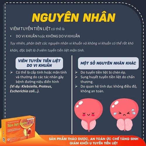 Nguyên nhân gây ra tuyến tiền liệt được chia ra làm 4 nhưng quay quanh việc tác động từ vi khuẩn hoặc không do vi khuẩn