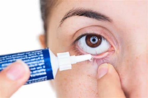 Thuốc mỡ tra mắt có tác dụng gì?